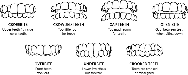 Invisalign Smile Assessment, Fairview Dentistry, St. Thomas